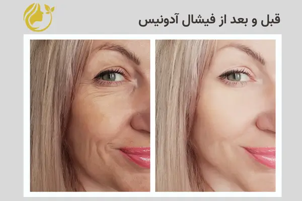 صفحه فرود خدمات فیشال 7 قبل و بعد از فیشال آدونیس 1