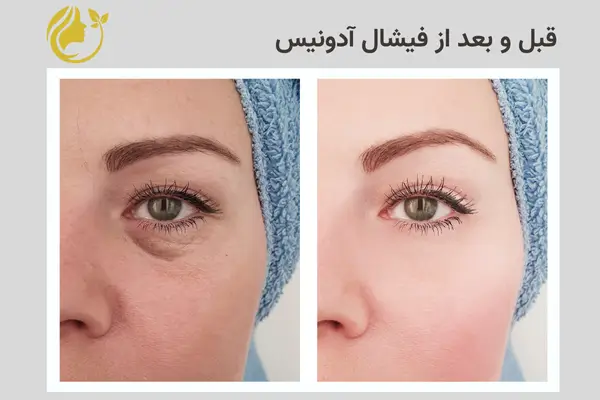 صفحه فرود خدمات فیشال 6 قبل و بعد از فیشال آدونیس 2