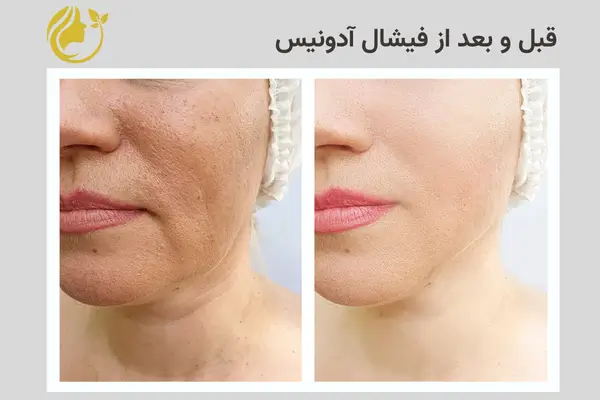 صفحه فرود خدمات فیشال 5 قبل و بعد از فیشال آدونیس 3