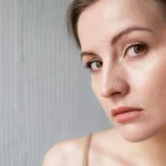 پاکسازی پوست برای درمان منافذ باز یا پوست پرتقالی