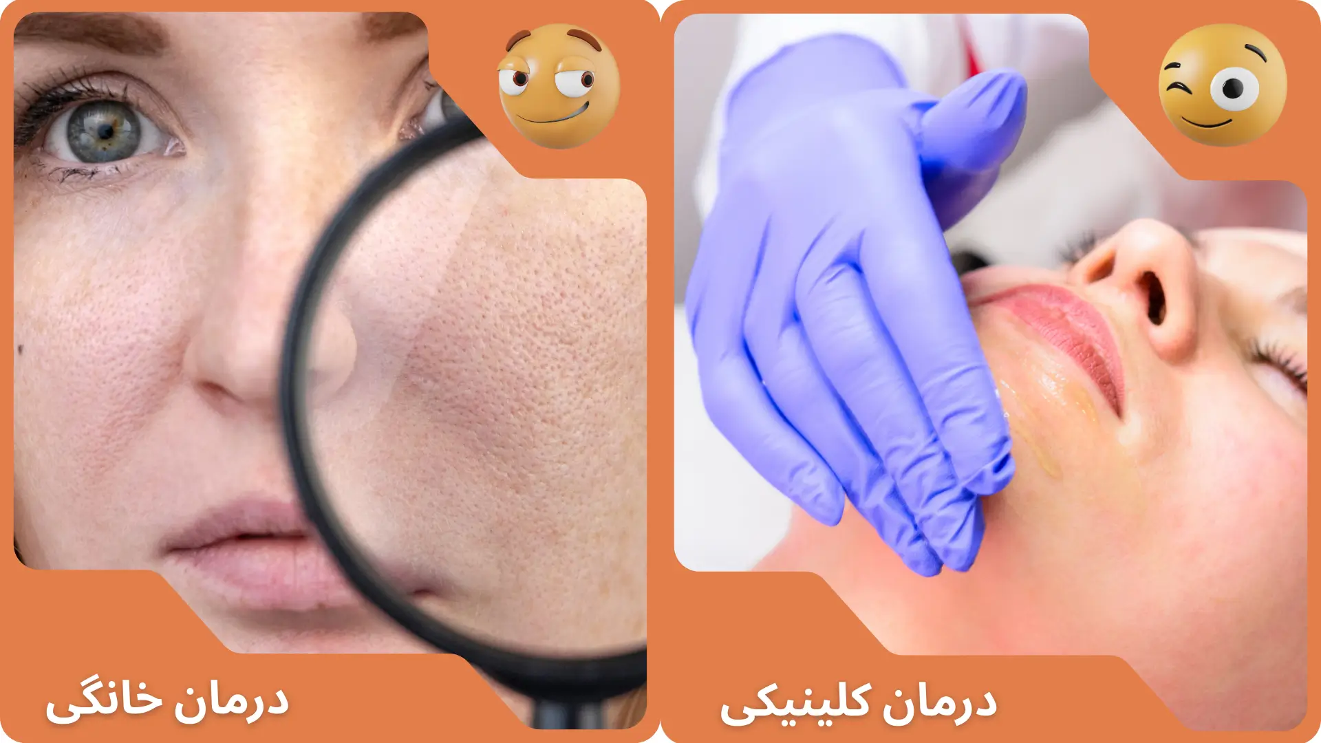 درمان منافذ باز پوست در خانه یا کلینیک