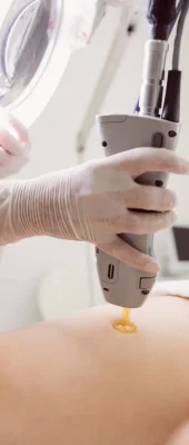 خدمات لیزر موهای زائد بدن کلینیک آدونیس