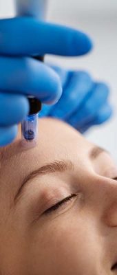 میکرونیدلینگ کلینیک آدونیس 1