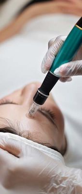 میکرونیدلینگ کلینیک آدونیس 3